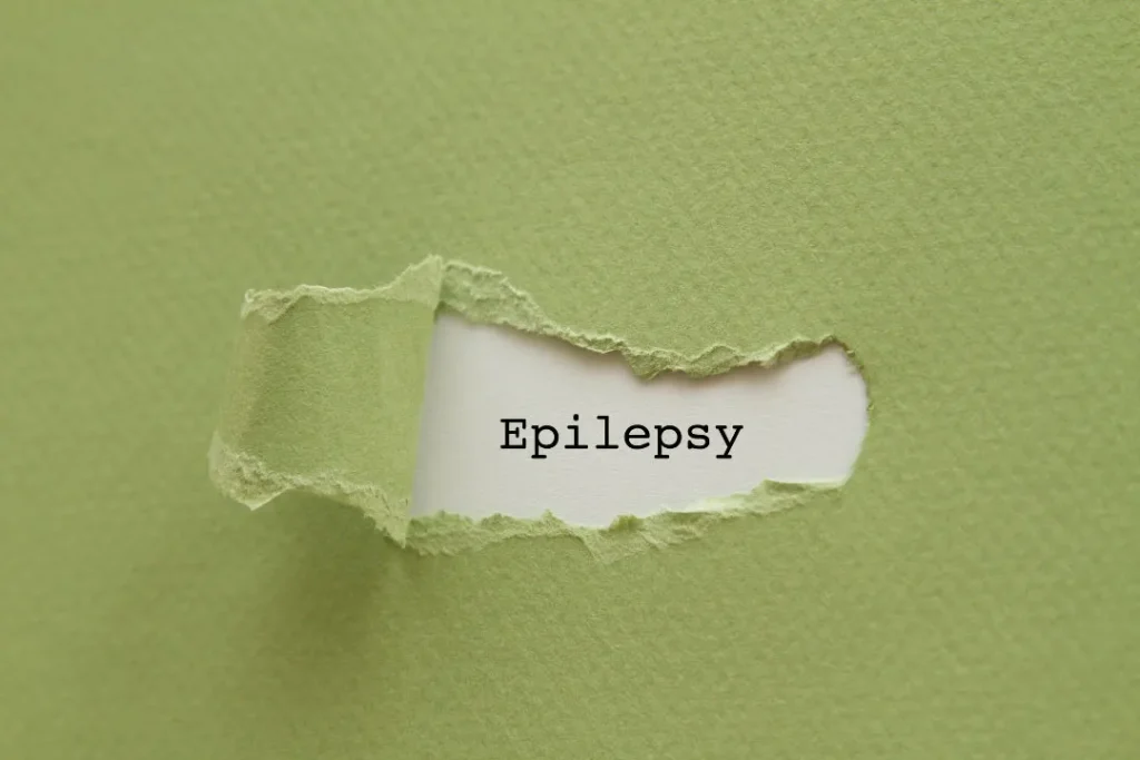 Epilepsy. 