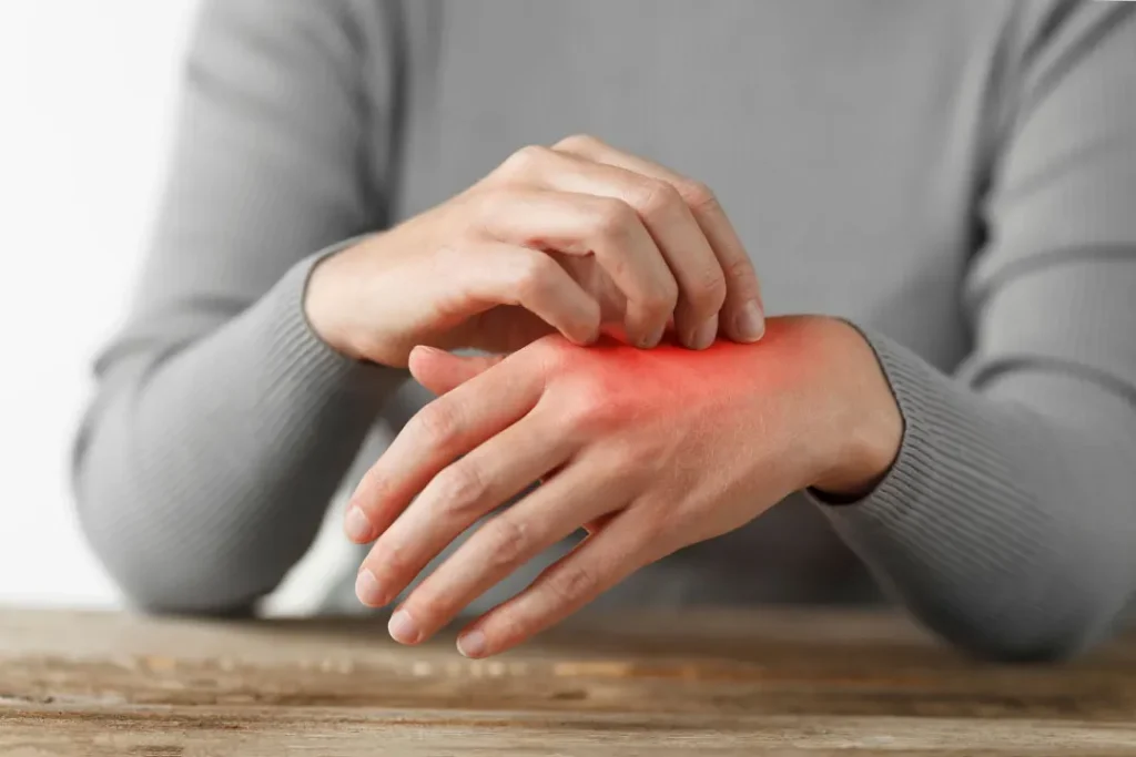 Itching on hand.
