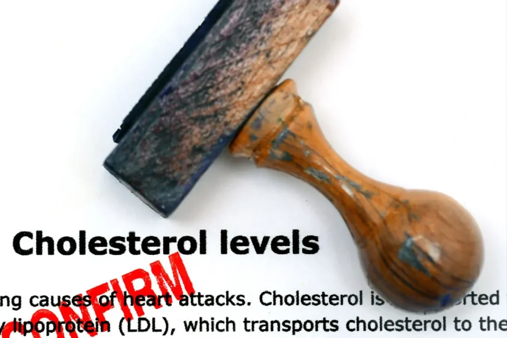 High cholesterol levels are dangerous for health. 