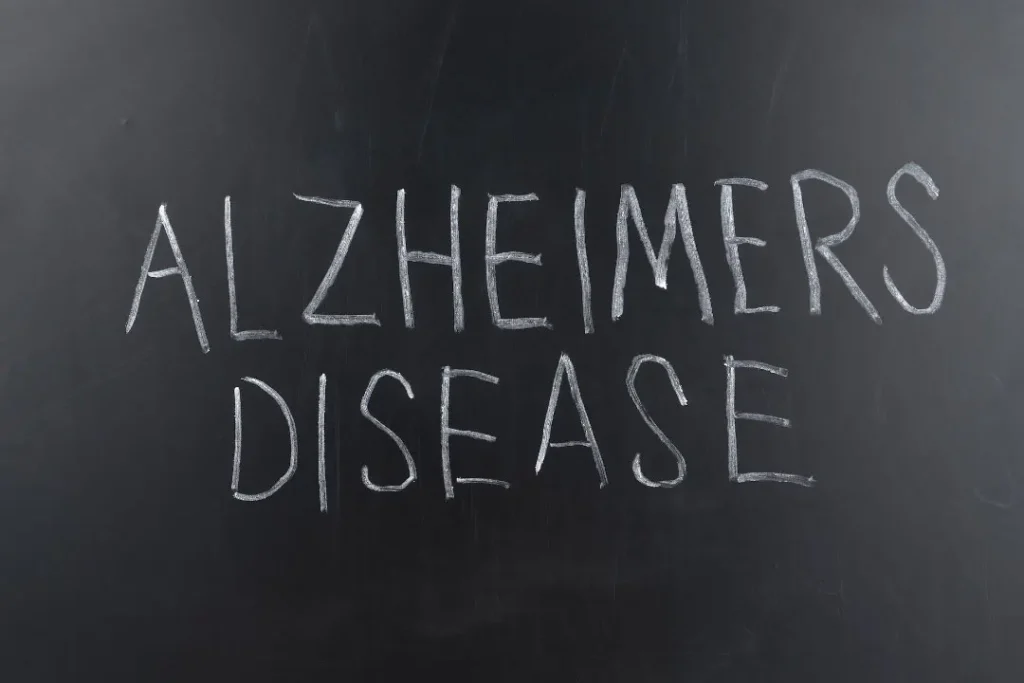Alzheimer's disease. 