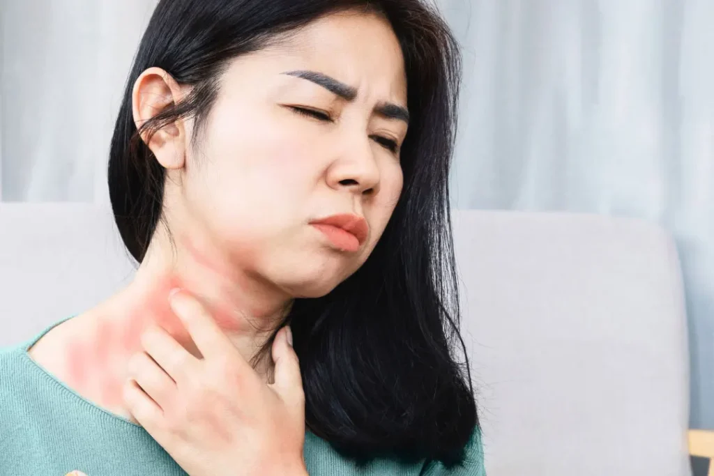A lady having allergy on her neck. 