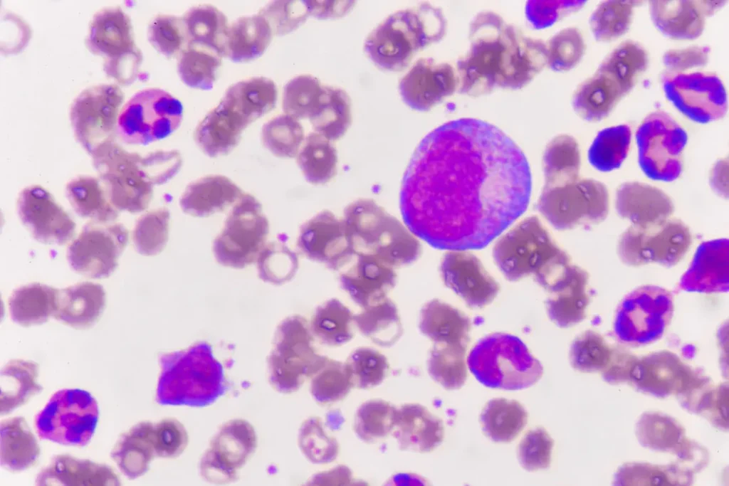 Immature red cells. 