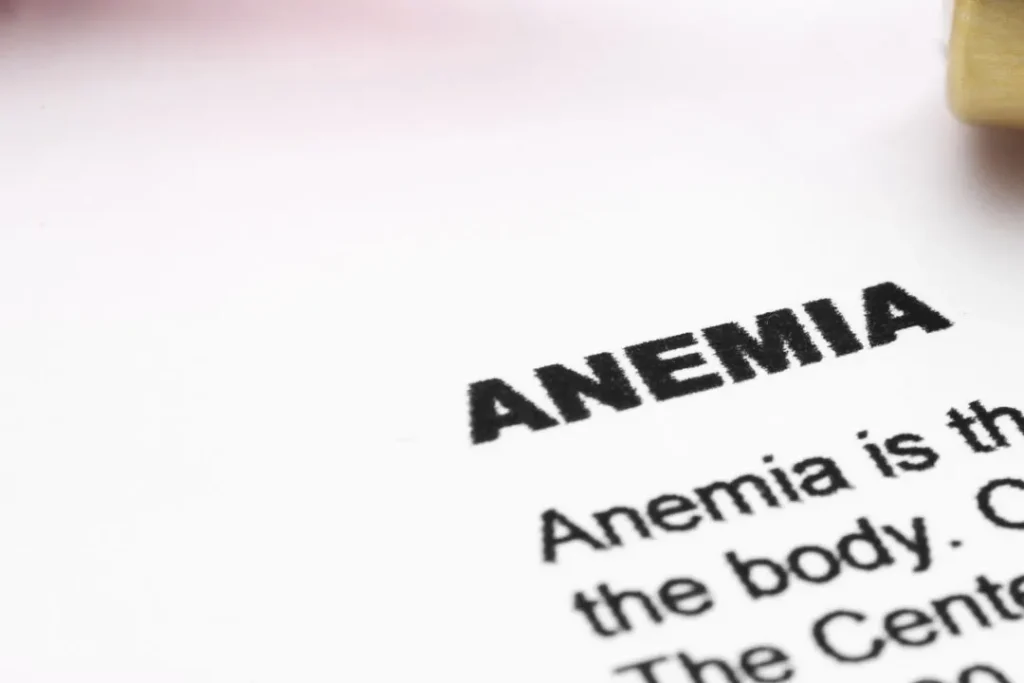 Anemia. 