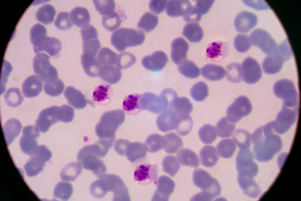 Plasmodium in blood. 