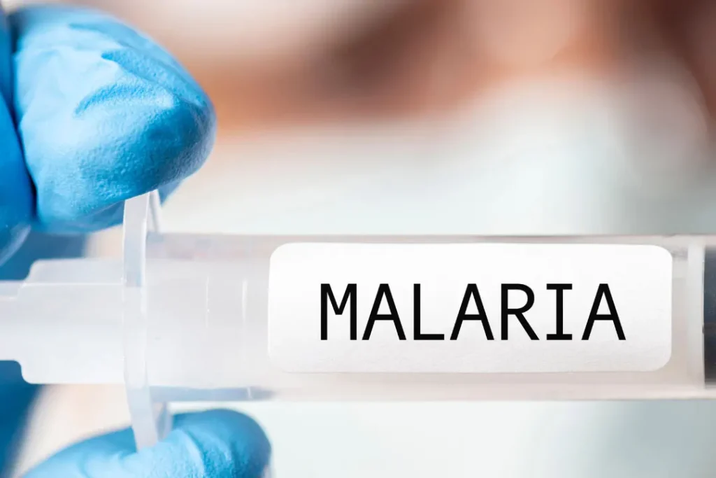 Malaria. 