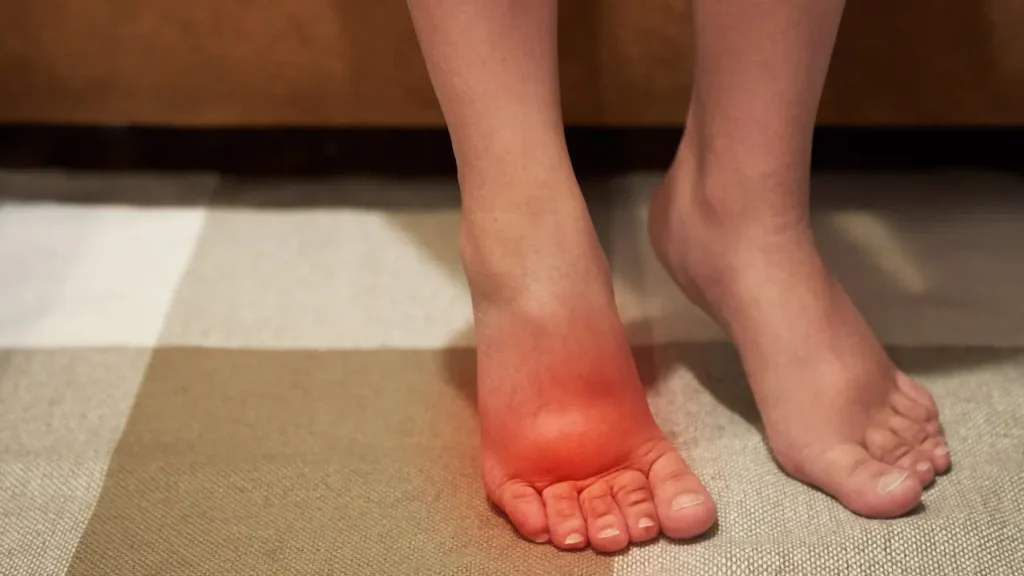 Foot swelling.