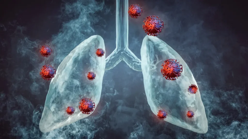 Germs attacking the lungs. 