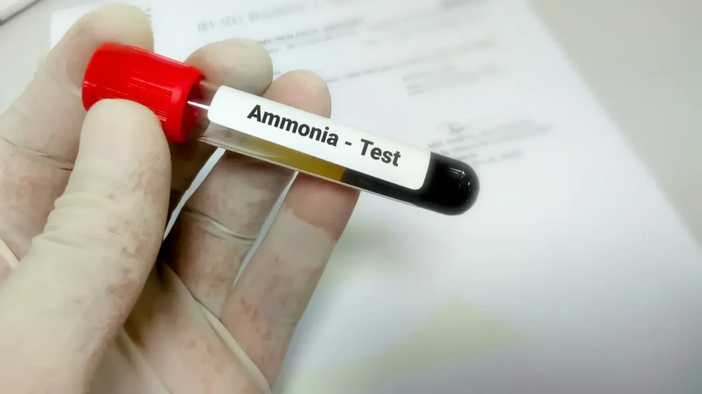 Ammonia blood test. 
