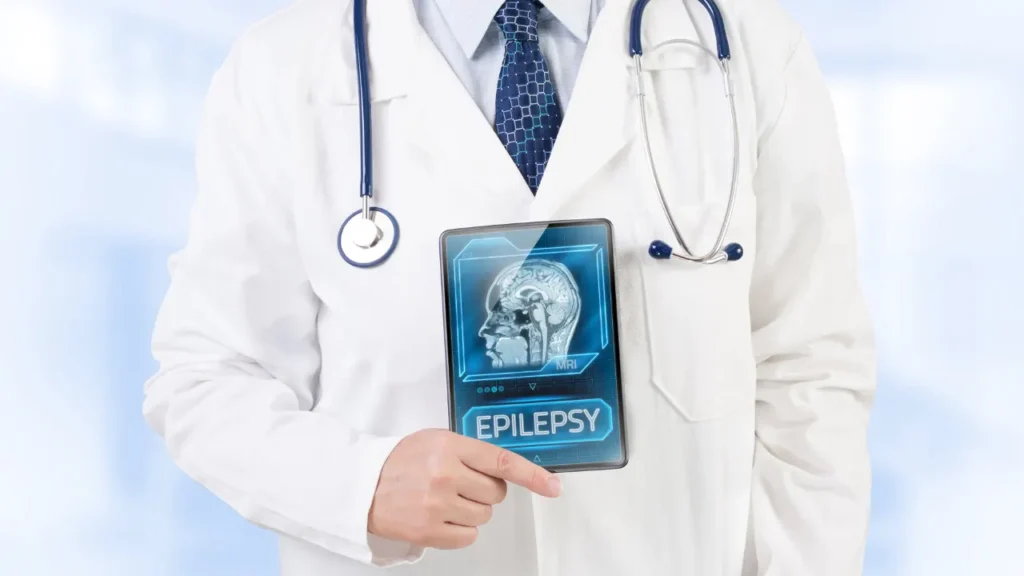 Epilepsy. 