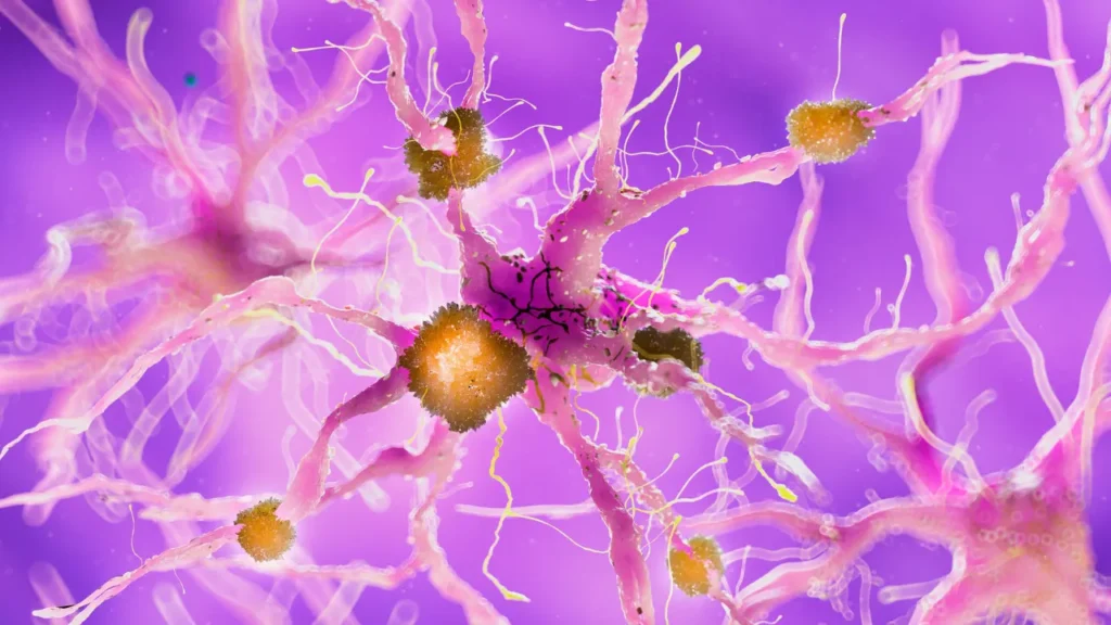 Germs attacking the neurons. 