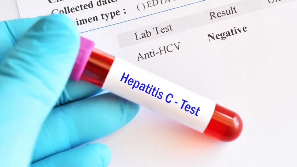 Hepatitis C test. 